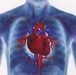Afectiuni cardiace