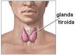 Afectiuni glanda tiroida