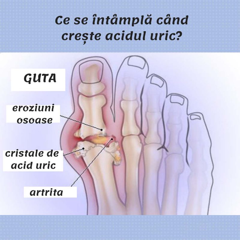 nederlands articulatie onderzoek dureri de genunchi în articulație