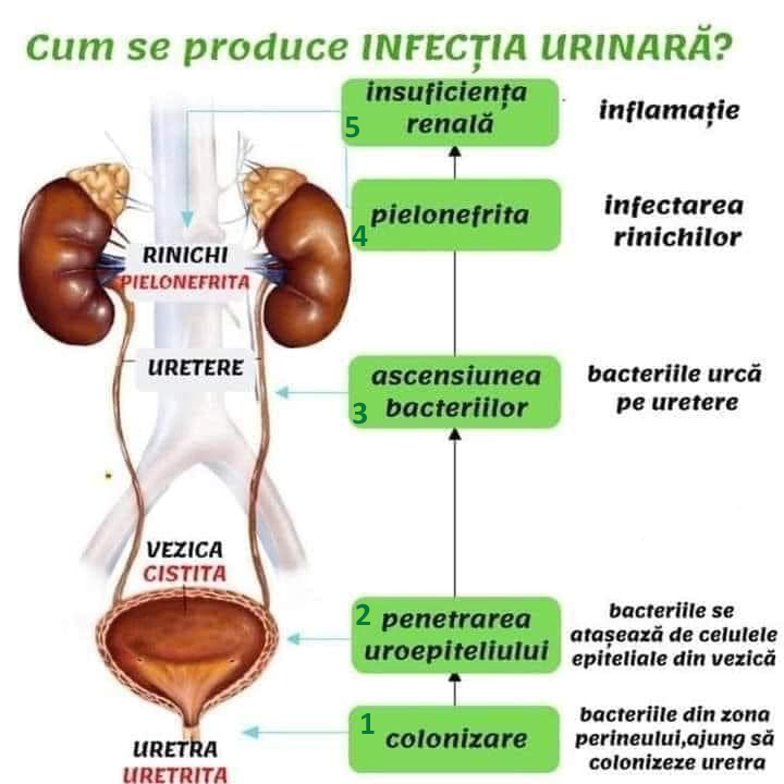 Infectia urinara