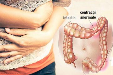 mișcări intestinale de slăbire